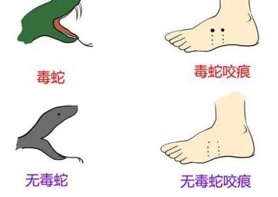 澳门研究生资料网站大全,和被蛇咬反抓蛇再遭咬与被蛇咬反抓蛇再遭咬伤
